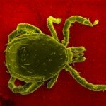 Les E.H.S. et la maladie de LYME